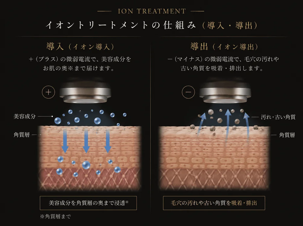 イオントリートメント