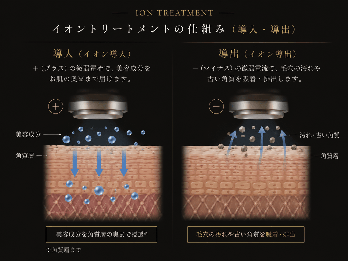 イオントリートメント
